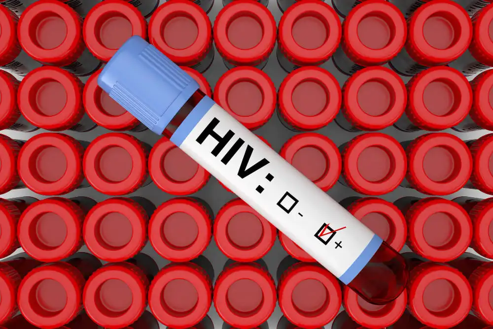 What Is HIV-Symptoms, Causes, Prevention and, Treatment