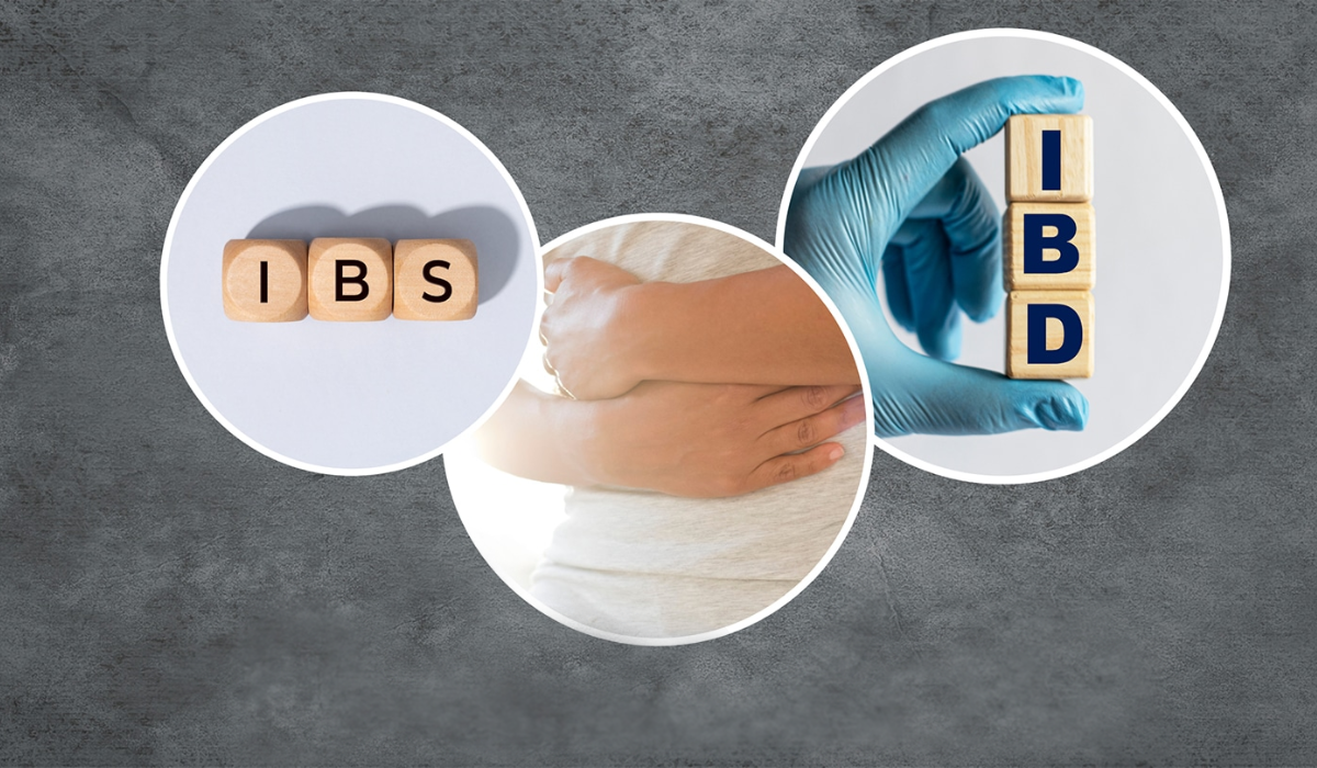 IBS OR IBD